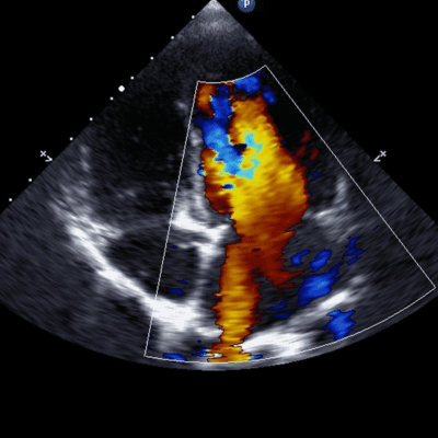 ইকোকার্ডিওগ্রাফি